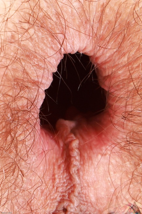 Skinny Hairy Pics